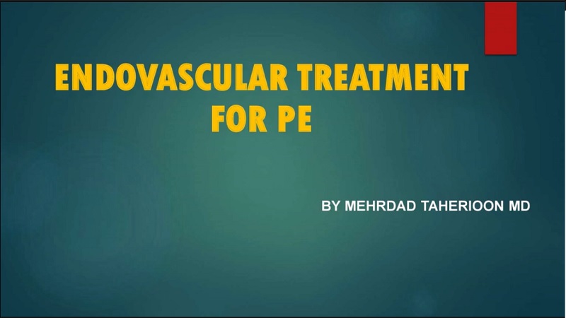 Endovascular treatment for PE | متخصص قلب اصفهان