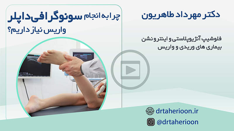 چرا به انجام سونوگرافی داپلر واریس نیاز داریم؟|متخصص واریس اصفهان